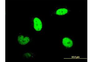 Immunofluorescence of monoclonal antibody to RNUT1 on HeLa cell. (Snurportin 1 antibody  (AA 1-360))