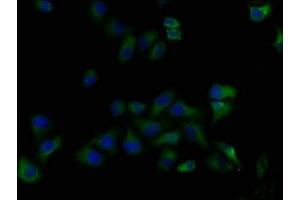 Immunofluorescence staining of Hela cells with ABIN7139916 at 1:50, counter-stained with DAPI. (LPAR5 antibody  (AA 310-326))