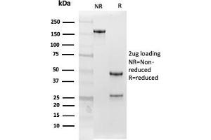 SDS-PAGE Analysis Purified Follistatin Mouse Monoclonal Antibody (FST/4282). (Follistatin antibody)
