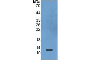 WB of Protein Standard: different control antibodies against Highly purified E. (CXCL7 ELISA Kit)