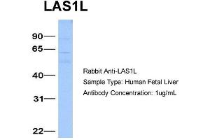 Host:  Rabbit  Target Name:  LAS1L  Sample Type:  Human Fetal Liver  Antibody Dilution:  1. (LAS1L antibody  (Middle Region))