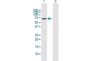 Western Blot analysis of CTNNA3 expression in transfected 293T cell line by CTNNA3 MaxPab polyclonal antibody. (CTNNA3 antibody  (AA 1-516))