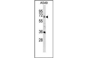 Western blot analysis of DDX28 Antibody (DDX28 antibody  (C-Term))