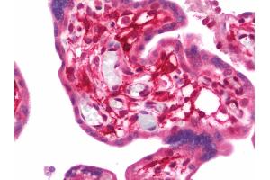Immunohistochemistry (IHC) image for anti-Poliovirus Receptor-Related 2 (Herpesvirus Entry Mediator B) (PVRL2) (AA 270-499) antibody (ABIN1928310)