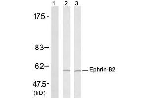 Western blot analysis of extract from H (Ephrin B2 antibody)
