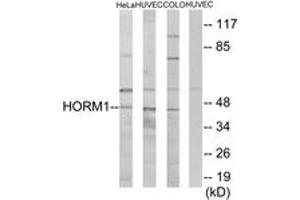 Western blot analysis of extracts from HeLa/HuvEc/COLO cells, using HORMAD1 Antibody. (HORMAD1 antibody  (AA 321-370))