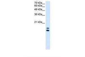Image no. 1 for anti-Ubiquitously-Expressed, Prefoldin-Like Chaperone (UXT) (N-Term) antibody (ABIN321839) (UXT antibody  (N-Term))