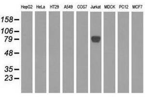 Image no. 3 for anti-EPM2A (Laforin) Interacting Protein 1 (EPM2AIP1) antibody (ABIN1498043) (EPM2AIP1 antibody)