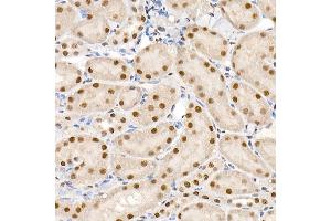 Immunohistochemistry of paraffin-embedded mouse kidney using Phospho-Smad2-S465/467 + Smad3-S423/425 Rabbit pAb (ABIN6135314, ABIN6136248, ABIN6136249 and ABIN6225575) at dilution of 1:50 (40x lens). (SMAD2 / SMAD3 (pSer423), (pSer425) antibody)