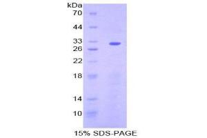 SDS-PAGE (SDS) image for Ectonucleoside Triphosphate diphosphohydrolase 1 (ENTPD1) (AA 98-352) protein (His tag) (ABIN2124693) (CD39 Protein (AA 98-352) (His tag))