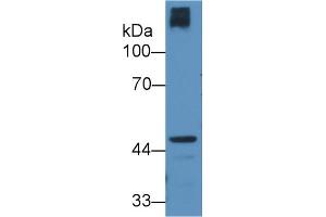 Detection of CRTAP in Human Hela cell lysate using Polyclonal Antibody to Cartilage Associated Protein (CRTAP)