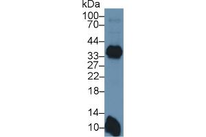 Detection of HLA-DRB1 in Mouse Spleen lysate using Polyclonal Antibody to HLA Class II Histocompatibility Antigen, DRB1 Beta Chain (HLA-DRB1) (HLA-DRB1 antibody  (AA 27-264))