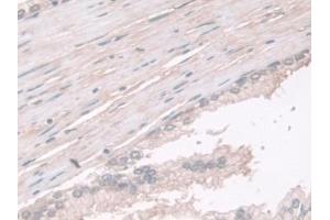 Detection of PGM1 in Human Prostate Tissue using Polyclonal Antibody to Phosphoglucomutase 1 (PGM1) (Phosphoglucomutase 1 antibody  (AA 1-235))