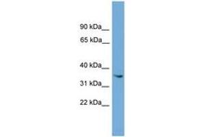 Image no. 1 for anti-Ankyrin Repeat and SOCS Box Containing 17 (ASB17) (AA 143-192) antibody (ABIN6744975) (ASB17 antibody  (AA 143-192))