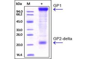 Ebolavirus EBOV (subtype Zaire,strain Kikwit-95) GP on SDS-PAGE under reducing (R) condition. (Glycoprotein / GP (Virus) (AA 33-637) protein (His tag))