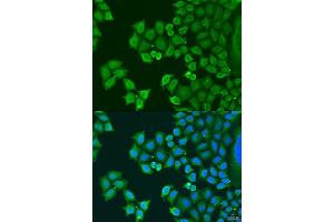 Immunofluorescence analysis of U2OS cells using SYT4 antibody (ABIN6129135, ABIN6148791, ABIN6148792 and ABIN6223676) at dilution of 1:100. (SYT4 antibody  (AA 38-190))