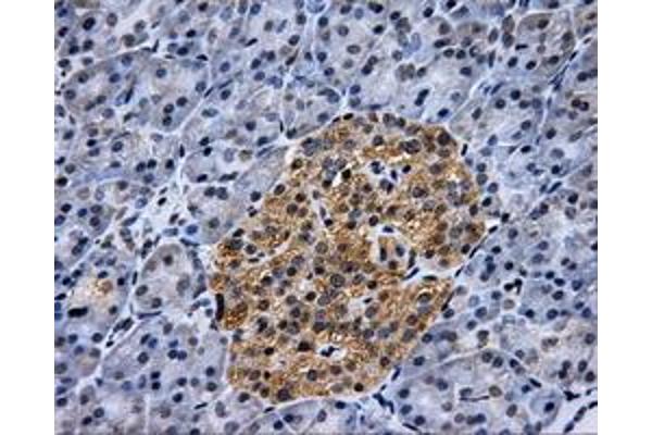 Hexokinase 2 antibody