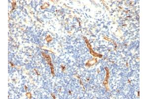 Formalin-fixed, paraffin-embedded human Tonsil stained with CD34 Monoclonal Antibody (HPCA1/1171) (CD34 antibody)