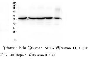 Western blot analysis of CCT3 using anti-CCT3 antibody . (CCT3 antibody  (C-Term))