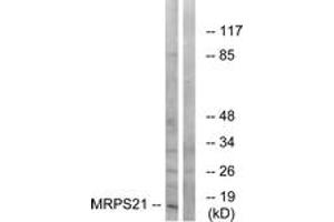 Western Blotting (WB) image for anti-Mitochondrial Ribosomal Protein S21 (MRPS21) (AA 38-87) antibody (ABIN2890407)