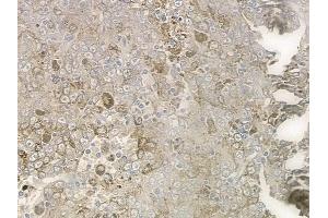 anti-ATP-Binding Cassette, Sub-Family B (MDR/TAP), Member 7 (ABCB7) (N-Term) antibody