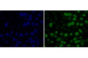Immunofluorescence analysis of 293T cells using MonoMethyl-Histone H3-K36 Polyclonal Antibody (Histone 3 antibody  (meLys36))