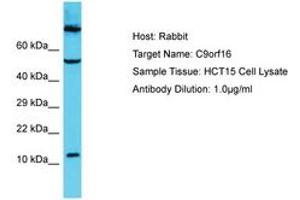 Image no. 1 for anti-Chromosome 9 Open Reading Frame 16 (C9orf16) (C-Term) antibody (ABIN6750667) (C9orf16 antibody  (C-Term))