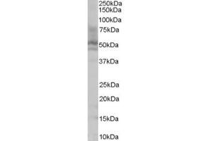 Western Blotting (WB) image for anti-Proline and Serine-Rich Protein 2 (PROSER2) (C-Term) antibody (ABIN2156450) (PROSER2 antibody  (C-Term))