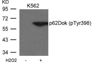 Western Blotting (WB) image for anti-Docking Protein 1, 62kDa (Downstream of tyrosine Kinase 1) (DOK1) (pTyr398) antibody (ABIN7138998)