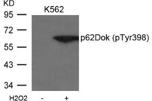 Western blot analysis of extracts from K562 cells untreated or treated with H2O2 using p62Dok(phospho-Tyr398) Antibody. (DOK1 antibody  (pTyr398))