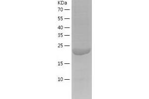 SMNDC1 Protein (AA 1-238) (His tag)