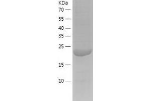 Western Blotting (WB) image for Survival Motor Neuron Domain Containing 1 (SMNDC1) (AA 1-238) protein (His tag) (ABIN7284658) (SMNDC1 Protein (AA 1-238) (His tag))