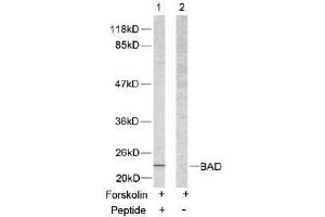 Image no. 2 for anti-BCL2-Associated Agonist of Cell Death (BAD) (Ser112) antibody (ABIN197208) (BAD antibody  (Ser112))