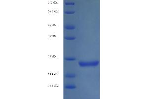 SDS-PAGE (SDS) image for Shiga Toxin Subunit B (STXB) (AA 21-89) protein (His-SUMO Tag) (ABIN5710672)