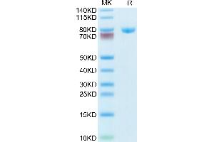 Transferrin Protein (TF) (AA 20-698) (His tag)