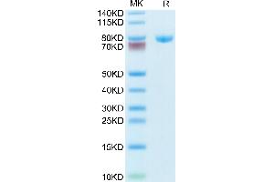 Human Transferrin on Tris-Bis PAGE under reduced condition. (Transferrin Protein (TF) (AA 20-698) (His tag))