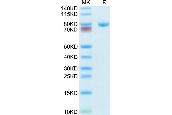 Transferrin Protein (TF) (AA 20-698) (His tag)