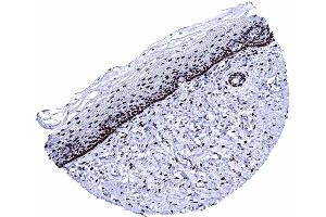 Uterus cervix An intense ER staining is seen in stromal cells and in the majority of squamous epithelial cells uf the uterine ectocervix (Recombinant Estrogen Receptor alpha antibody  (AA 495-595))