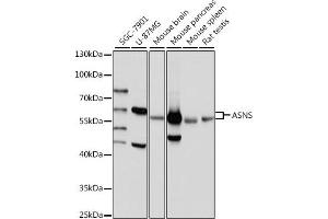 Western blot analysis of extracts of various cell lines, using ASNS antibody (ABIN7265693) at 1:1000 dilution. (Asparagine Synthetase antibody  (AA 262-561))