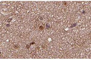 ABIN6266635 at 1/100 staining human brain tissue sections by IHC-P. (SNAP25 antibody  (C-Term))