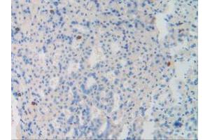 Figure. (Dynamin 1 antibody  (AA 572-745))