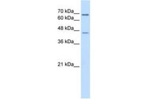 Image no. 2 for anti-Aldehyde Dehydrogenase 3 Family, Member A2 (ALDH3A2) (AA 351-400) antibody (ABIN6736668) (ALDH3A2 antibody  (AA 351-400))