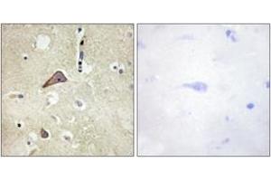 Immunohistochemistry analysis of paraffin-embedded human brain, using NMDAR1 (Phospho-Ser896) Antibody. (GRIN1/NMDAR1 antibody  (pSer897))