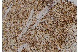 ABIN6274773 at 1/100 staining Rat spleen tissue by IHC-P. (RPL23 antibody  (C-Term))
