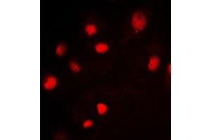 Immunofluorescent analysis of MCM2 staining in Jurkat cells.