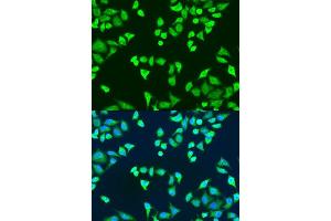 Immunofluorescence analysis of U2OS cells using SMN2 antibody. (SMN2 antibody  (AA 1-197))