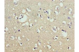 Immunohistochemistry of paraffin-embedded human brain tissue using ABIN7165209 at dilution of 1:100 (CNIH2 antibody  (AA 94-138))