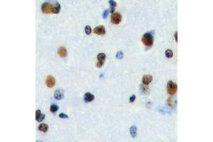 Immunohistochemical analysis of HEN1/2 staining in human brain formalin fixed paraffin embedded tissue section. (HEN1/2 (Center) antibody)