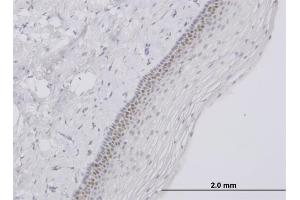 Immunohistochemistry (IHC) image for anti-Transcription Factor AP-4 (Activating Enhancer Binding Protein 4) (TFAP4) (AA 93-192) antibody (ABIN520838)
