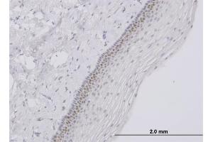 Immunoperoxidase of monoclonal antibody to TFAP4 on formalin-fixed paraffin-embedded human uterine cervix. (TFAP4 antibody  (AA 93-192))